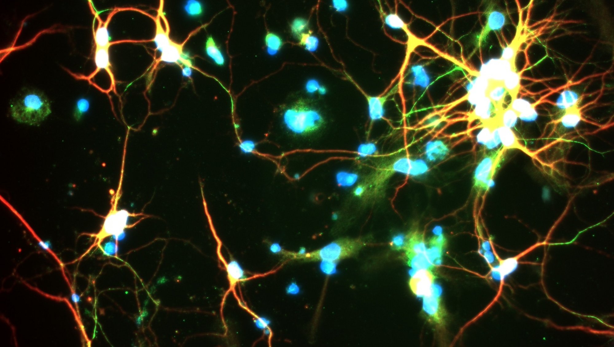 Rat hippocampal neurons, Annemette Boe Marnow