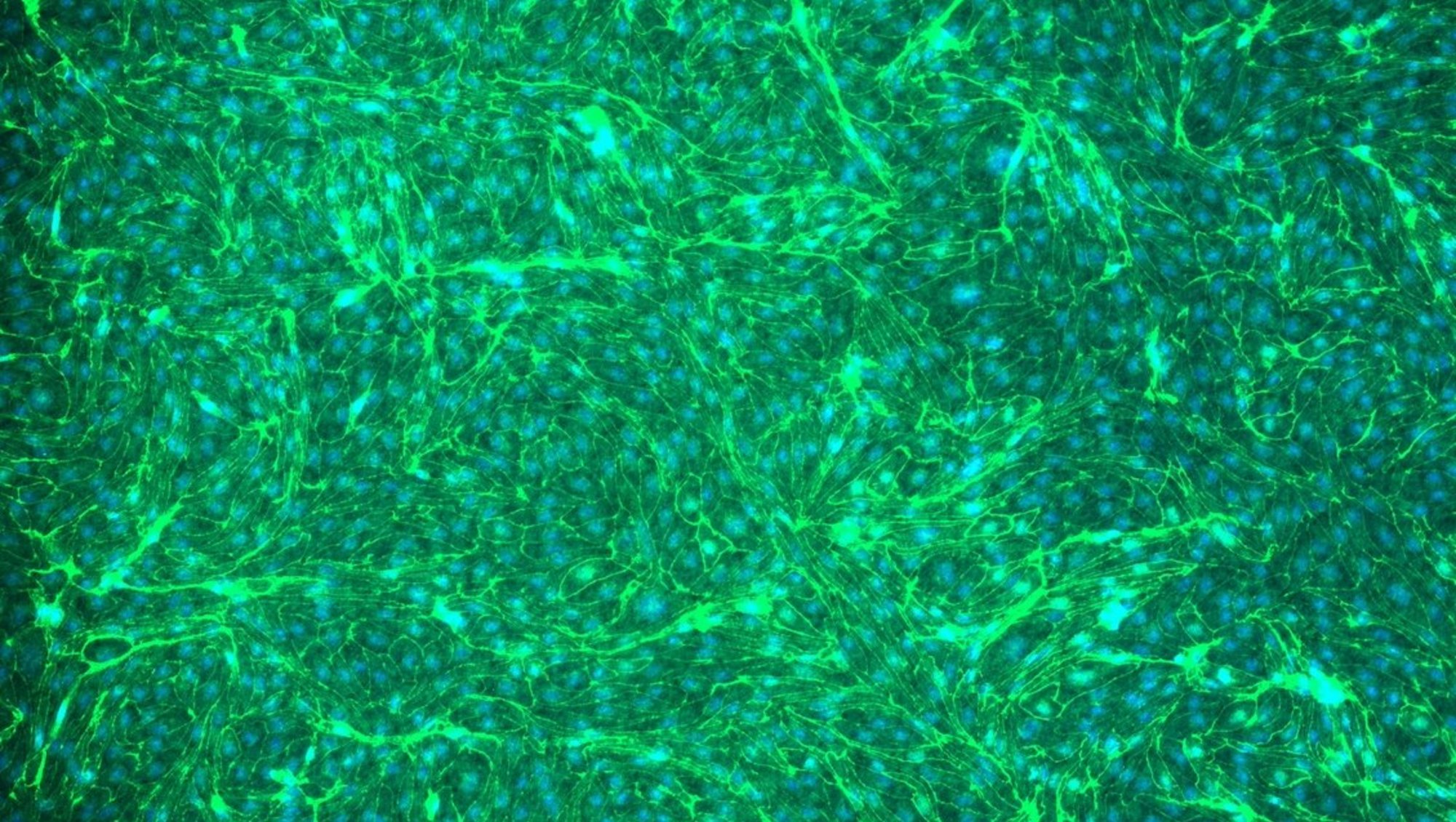 Porcine endothelial cells (pBECs), Annemette Boe Marnow